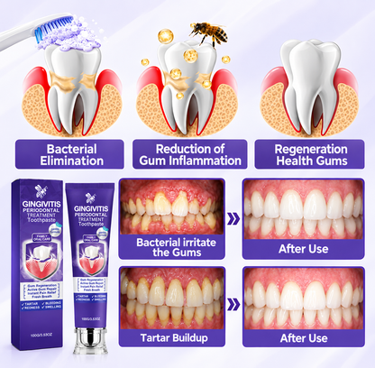 Bee Venom Gentle Gum Care Toothpaste