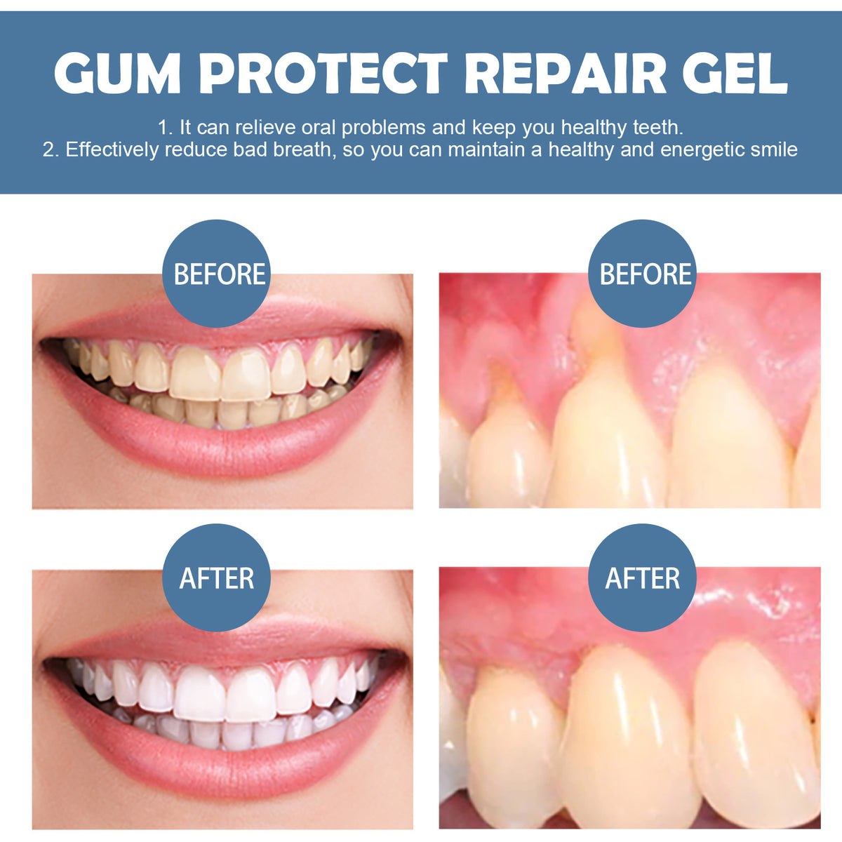 Suforge® Gum Protect Repair Gel