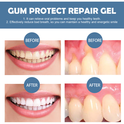 Suforge® Gum Protect Repair Gel