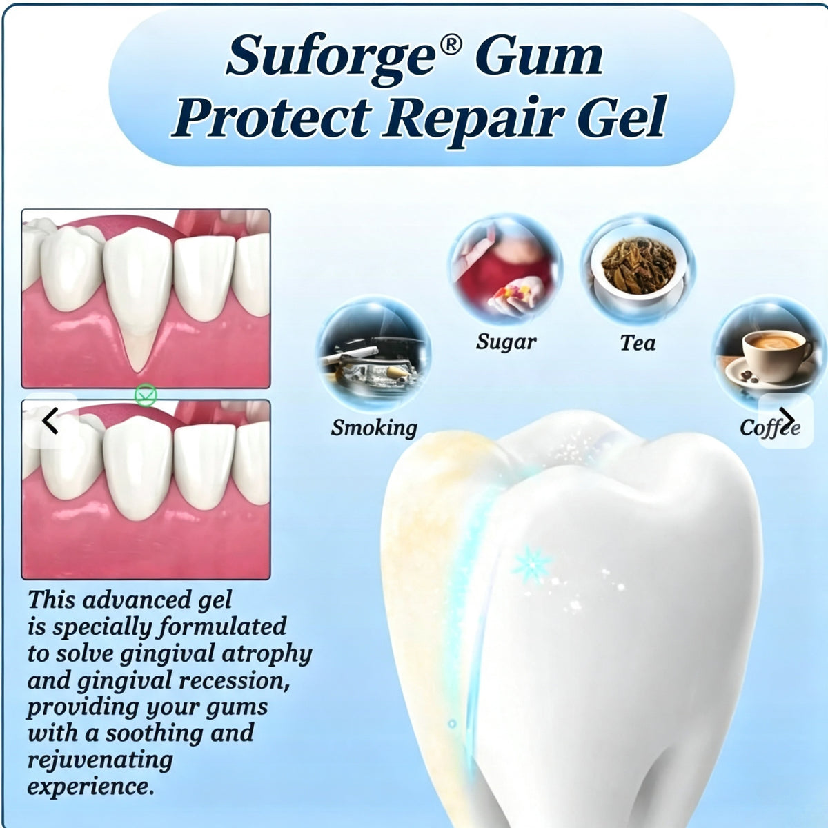 Suforge® Gum Protect Repair Gel